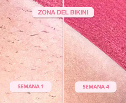 Depiladora Láser Permanente IPL